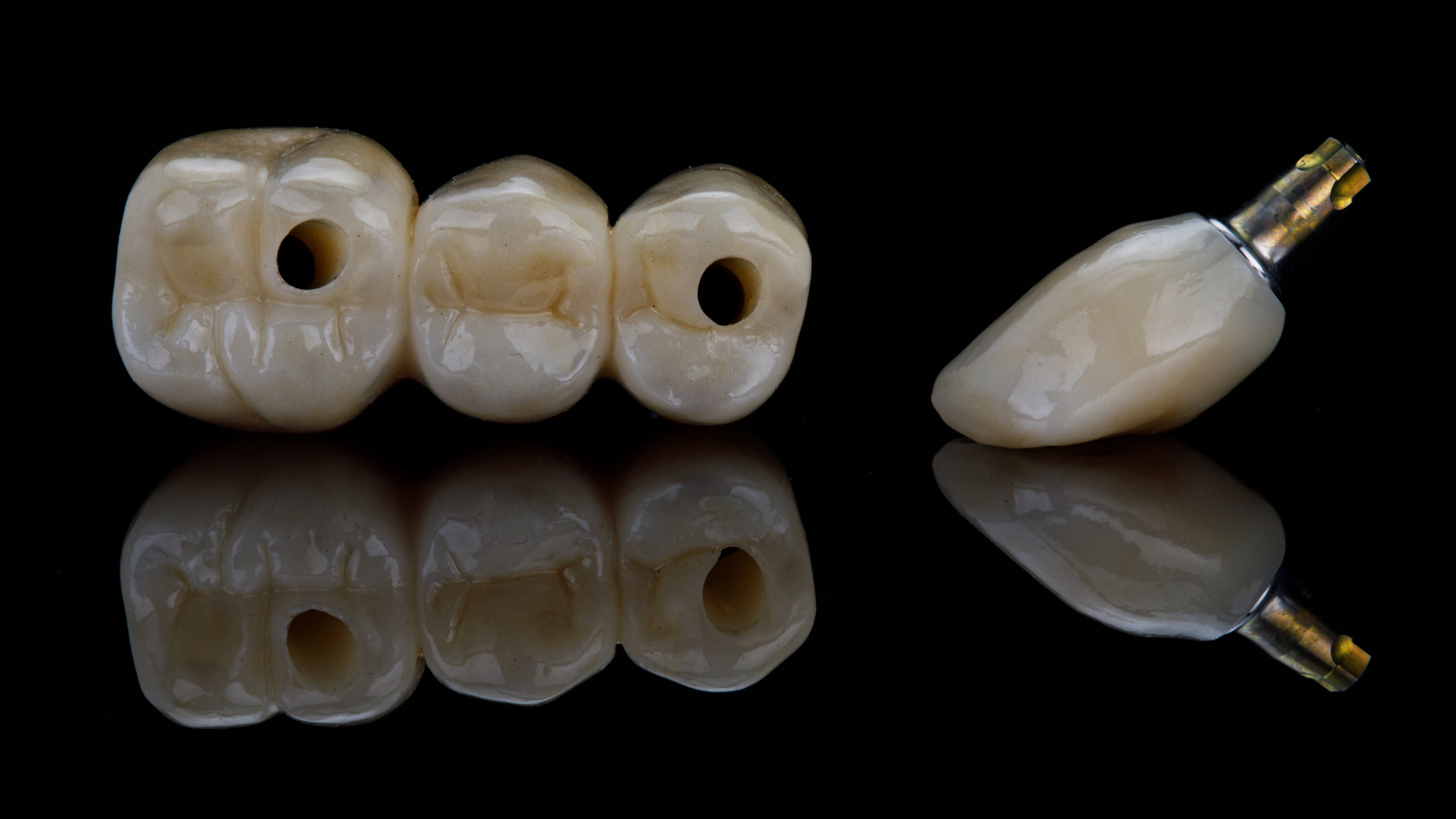 Composition,Dental,Bridge,And,One,Zircon,Crown,On,Black,Glass