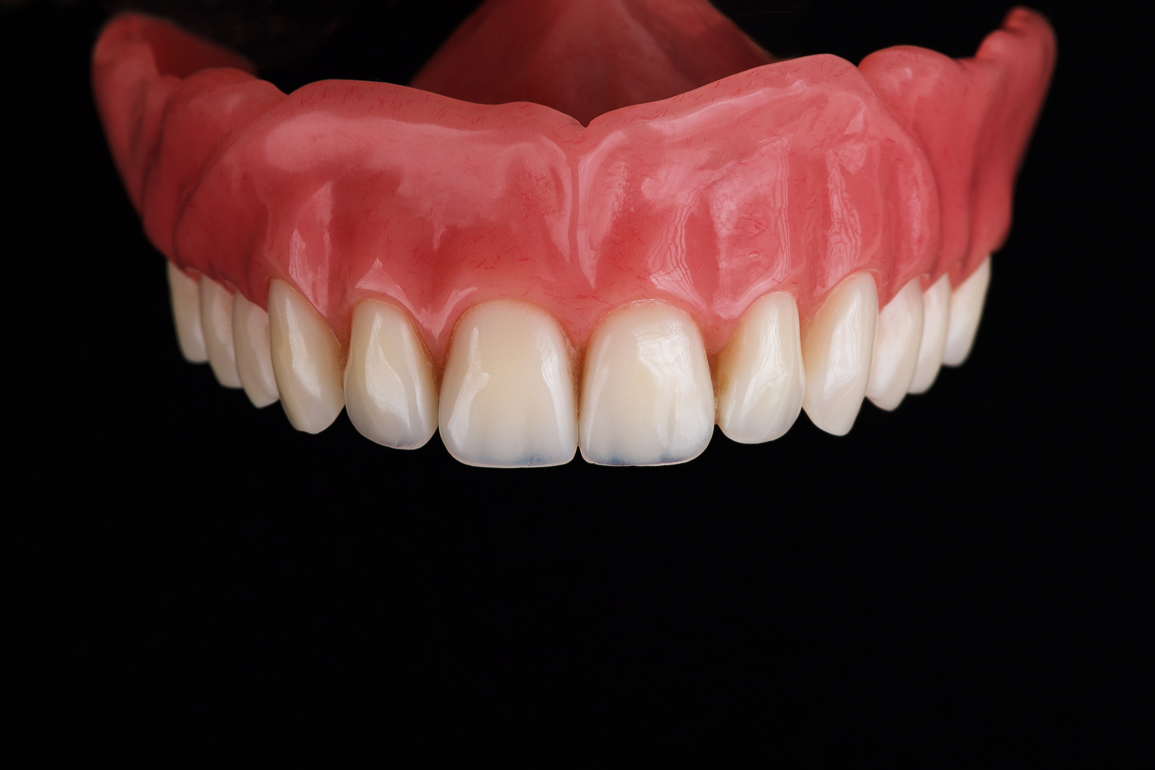 Upper,Part,Of,Denture,,Removed,On,A,Black,Background
